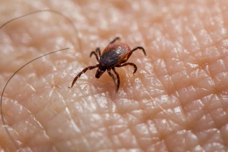 Borrelióza