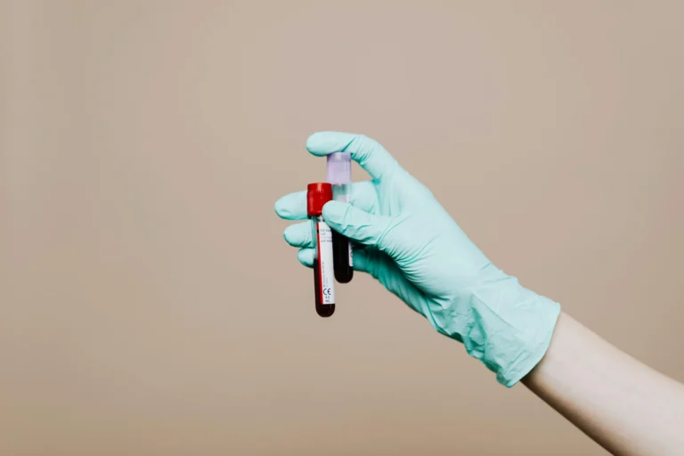 HIV